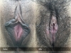labia-minora-clitoral-hood-reduction-vitasna-technique-13