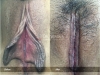 labia-minora-clitoral-hood-reduction-vitasna-technique-13